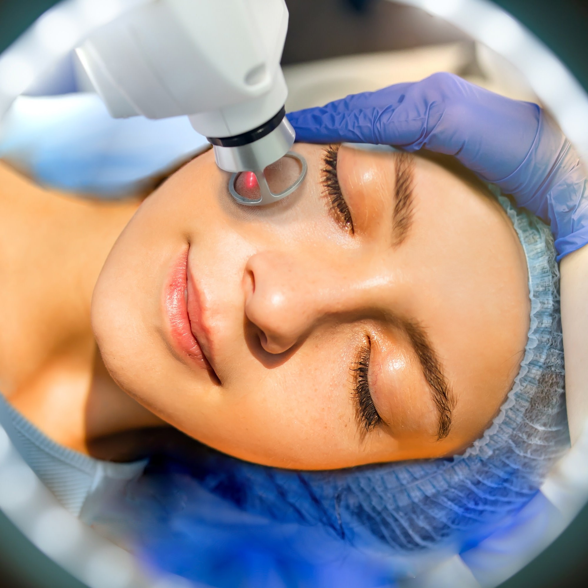 Pepti-Cell various laser treatments