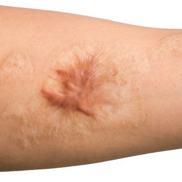 Pepti-Cell scar and bruise recovery